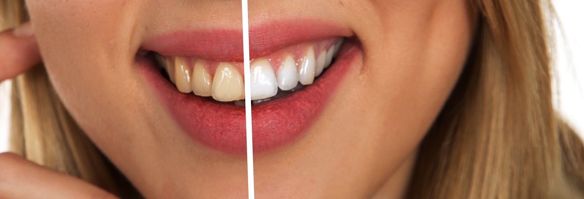 Comment avoir des dents plus blanches grâce au charbon actif ?